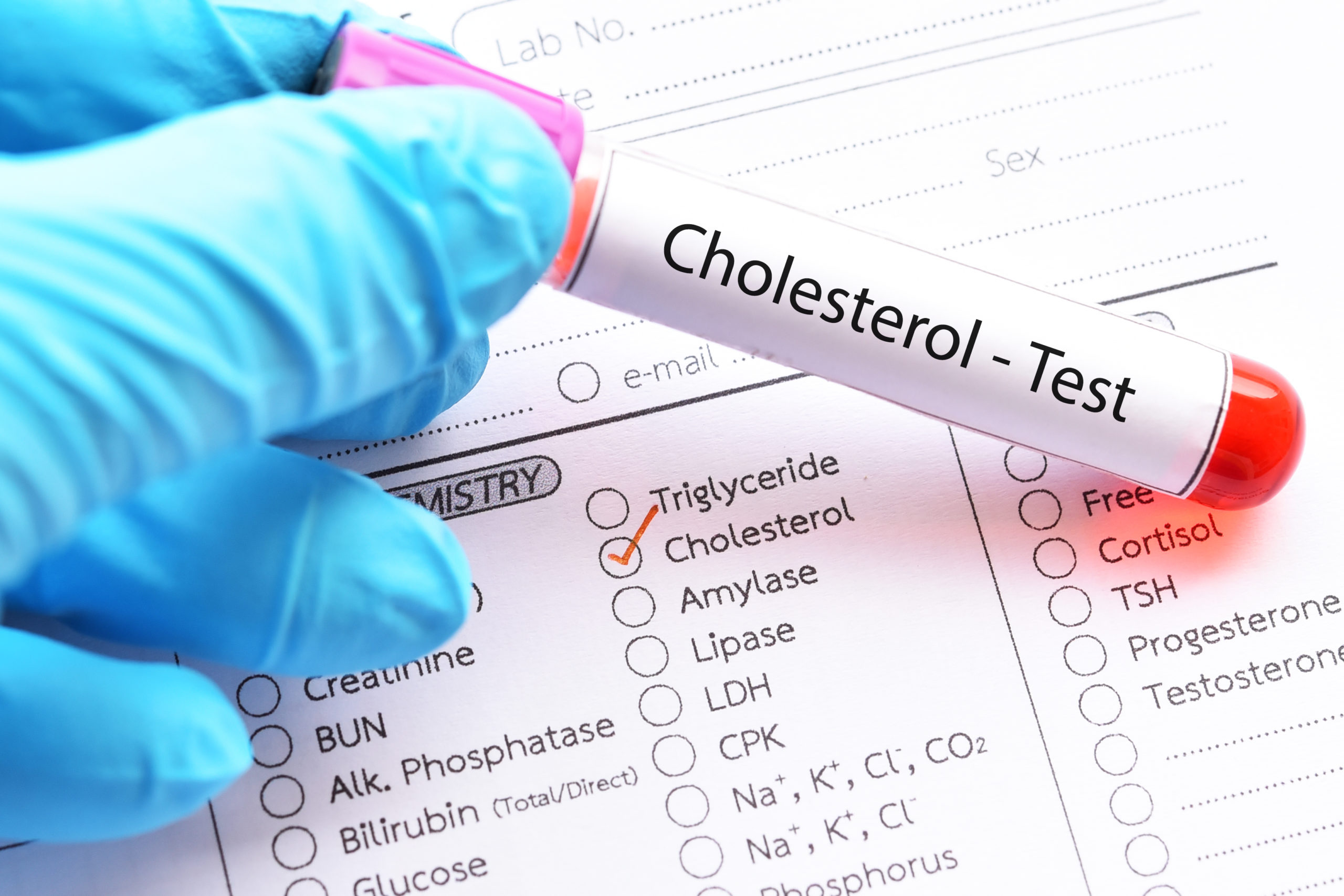 Understand Cholesterol Testing Testing